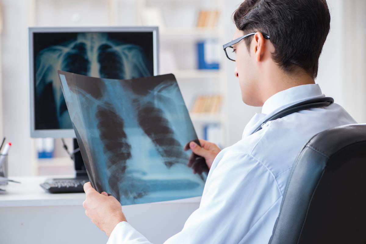 Diagnoza pljučnega raka