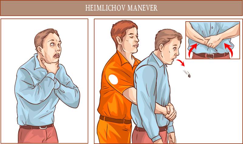 Hemlichov-manever